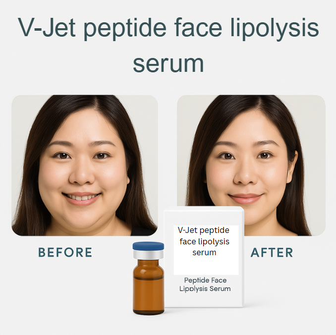 V-Jet Slimming Face